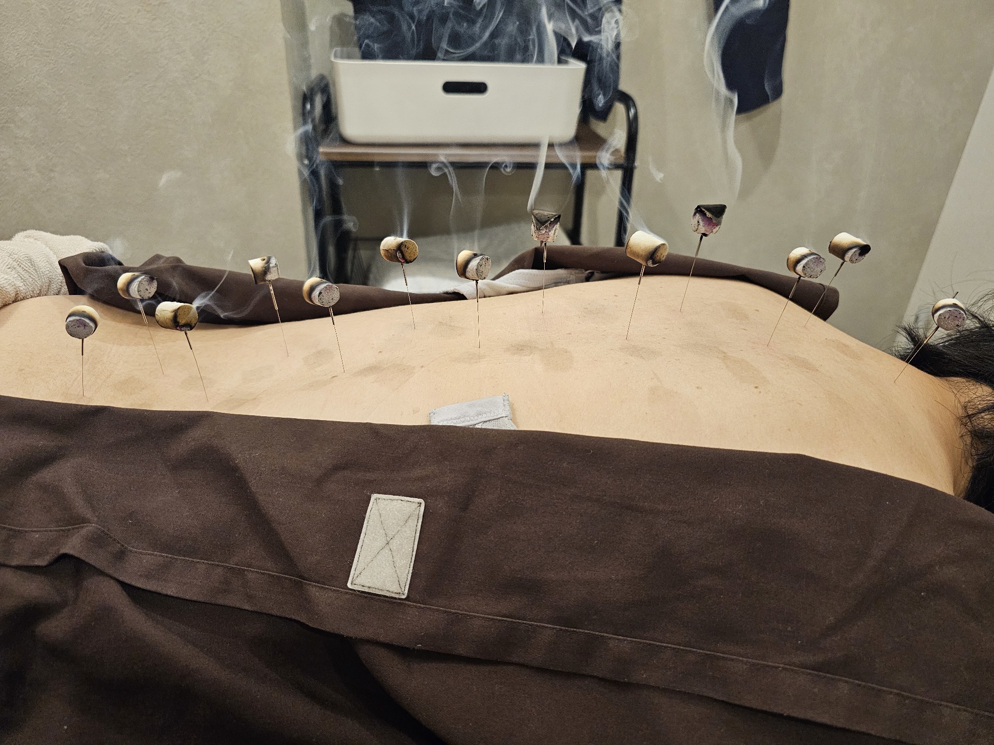 盤龍灸頭鍼で温泉気分