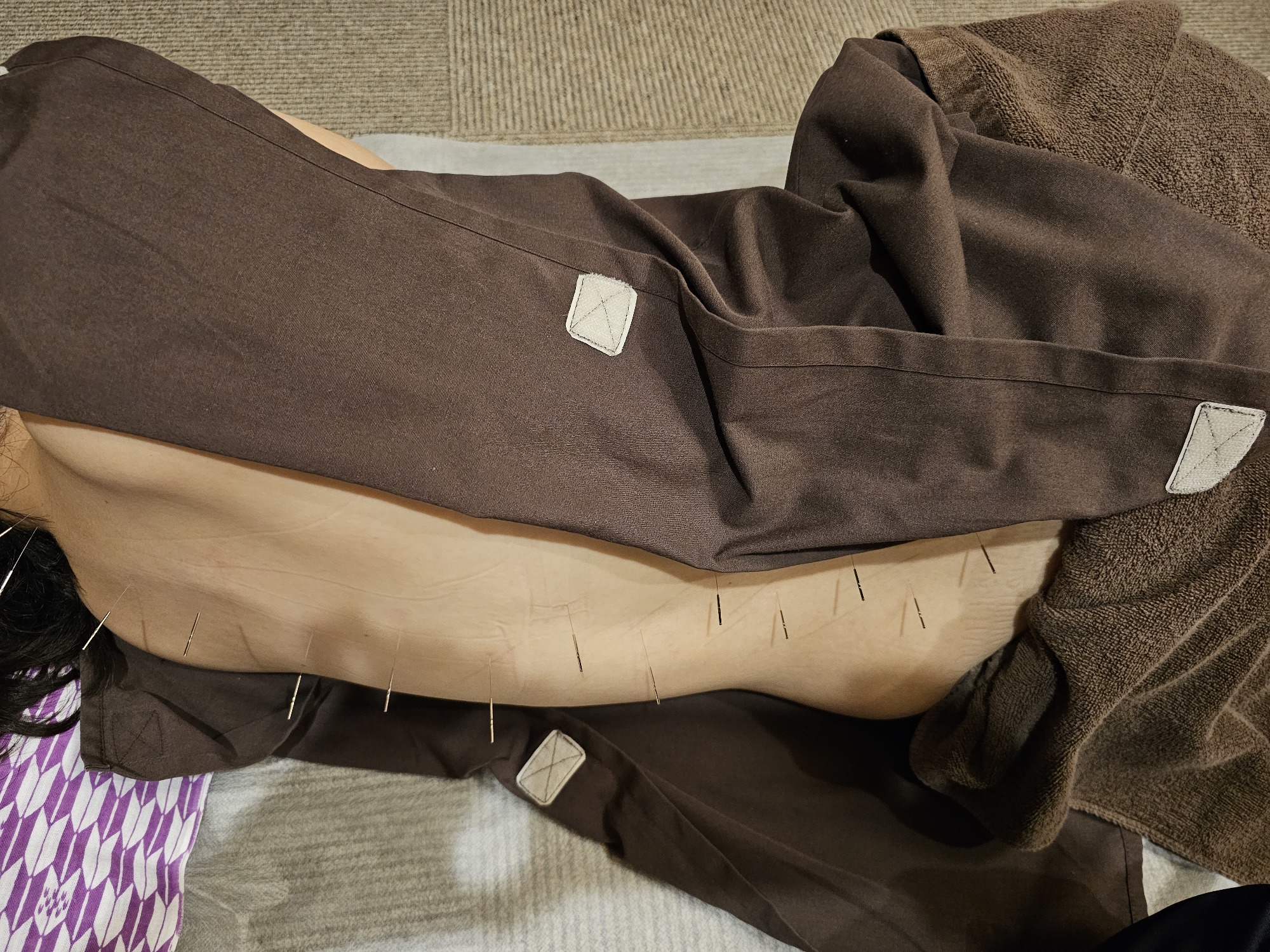 うつ伏せになれない方は横向きで施術します