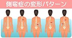 顎関節症・側弯症が同時に改善した理由～背骨へのアプローチが鍵～