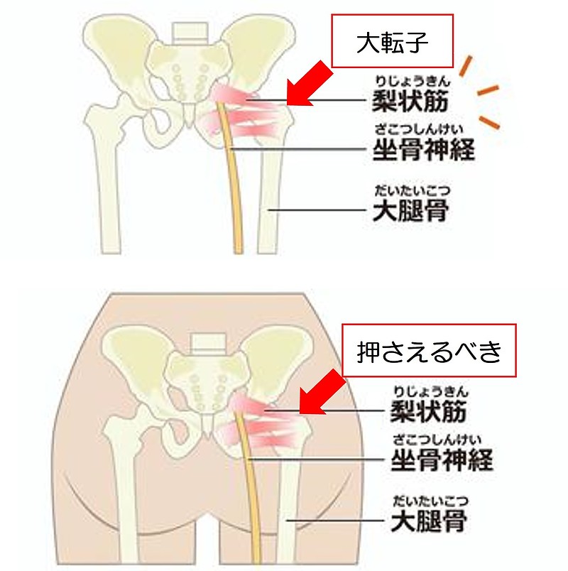 梨状筋