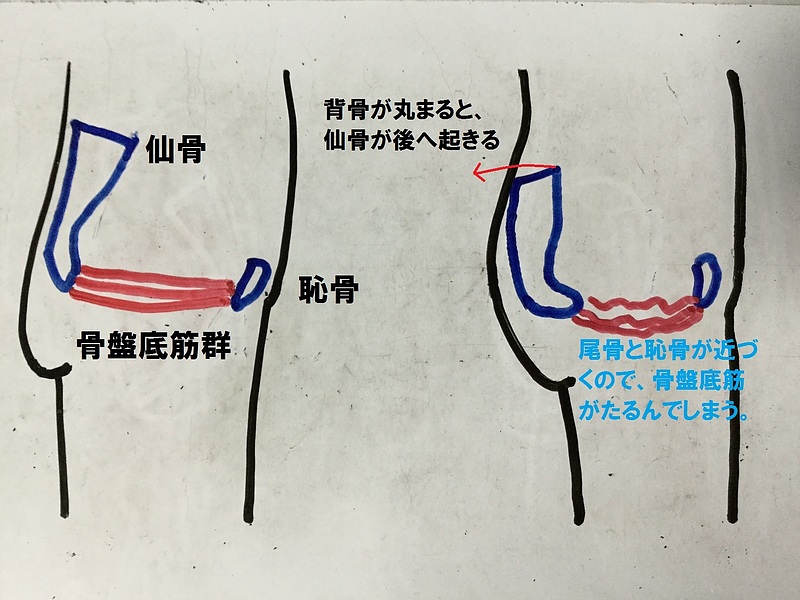 骨盤底筋　緩む