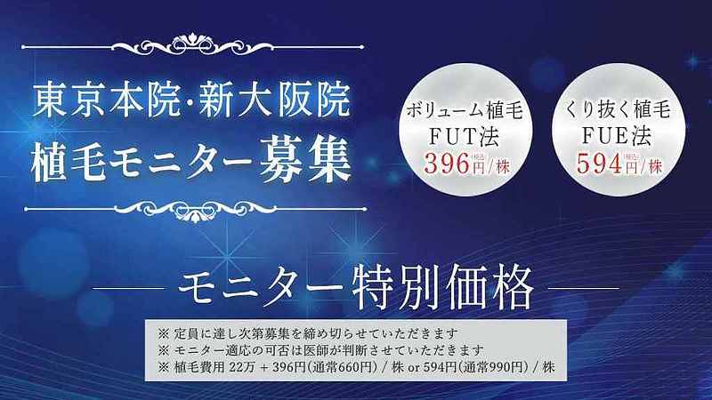 植毛モニタープラン 植毛モニタープラン