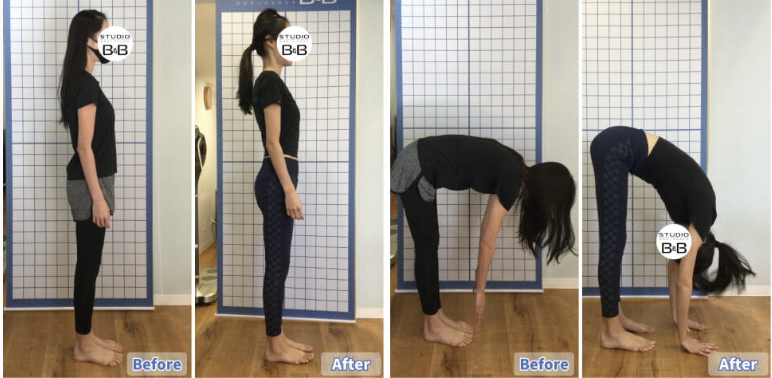 ピラティススタジオBBの会員様の姿勢改善例写真